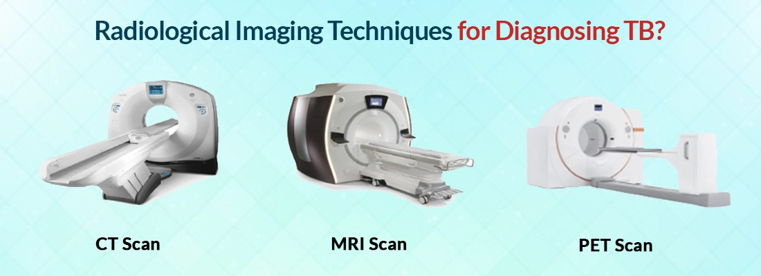 Radiological Imaging Techniques for Diagnosing TB